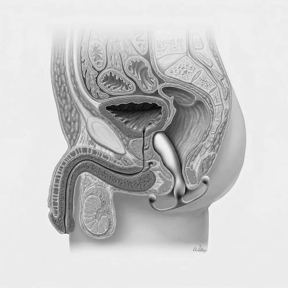 Aneros Prostate Massager Gif